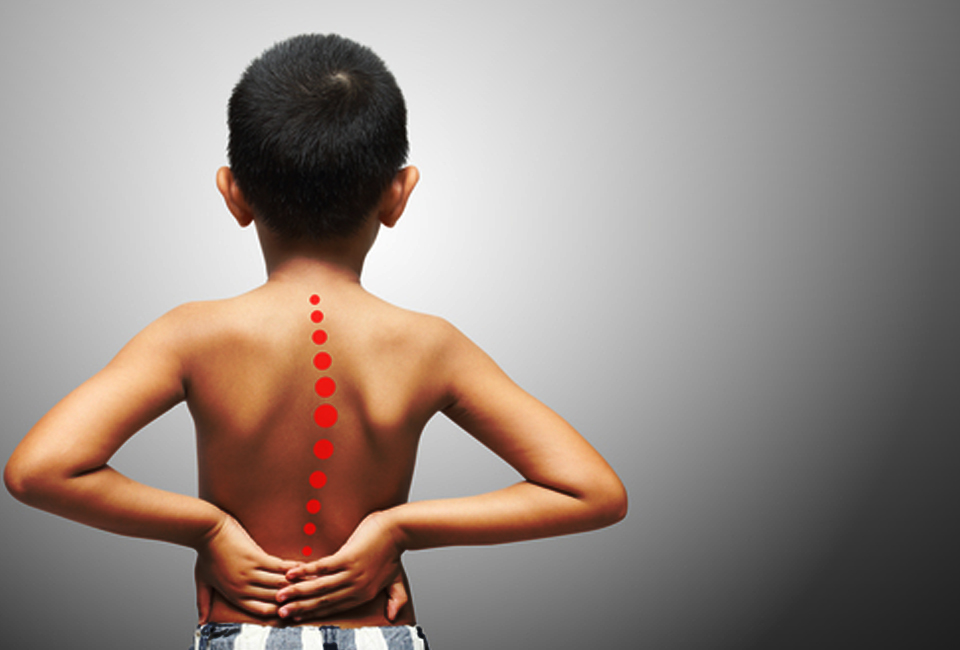 MD-Ashish-Patel-Condition-Img-Pediatric-Spinal-Disorders